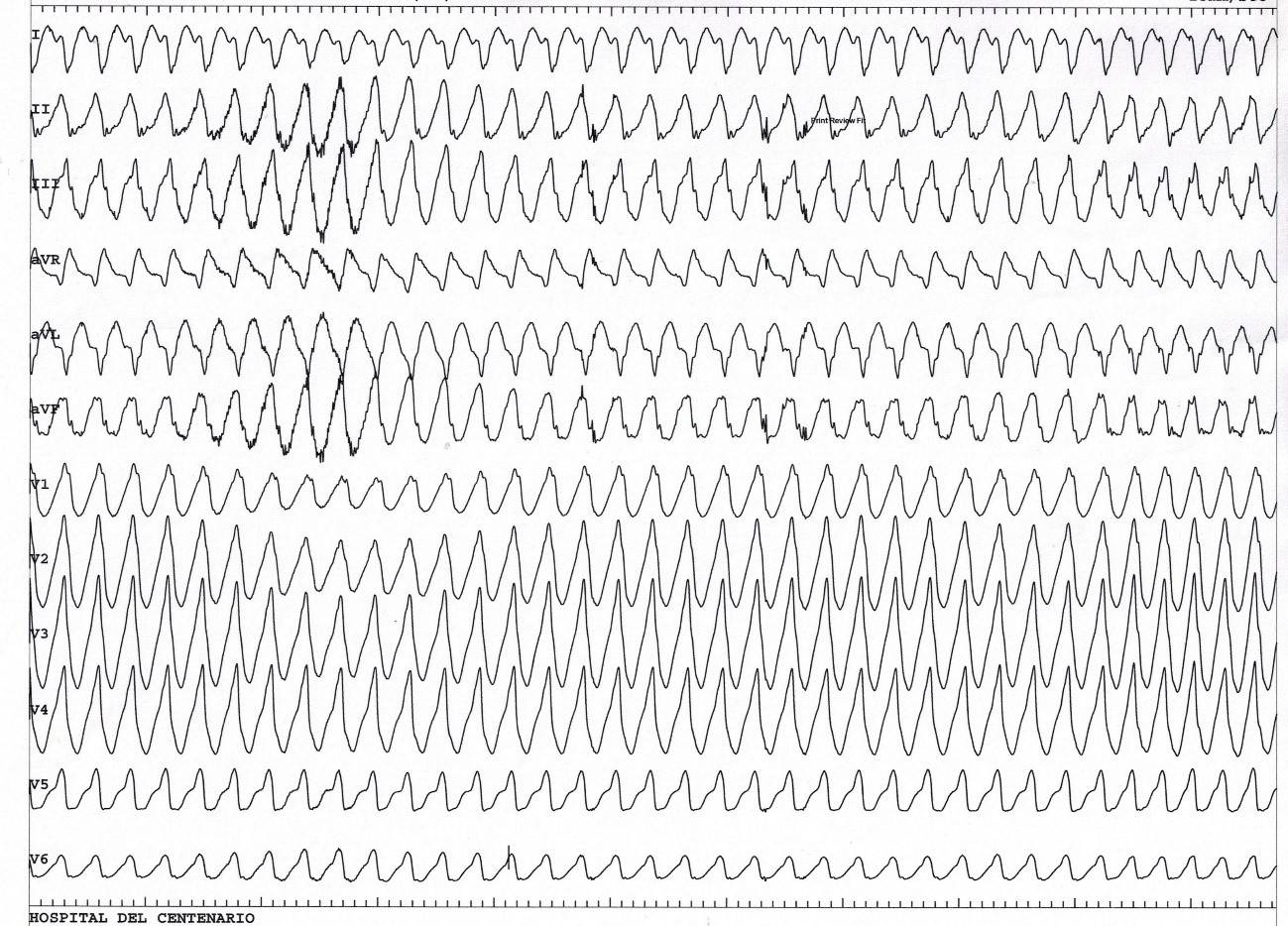 ECG Abril 2020